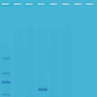 Kit d'expérimentation, Analyse de la qualité de l'eau III: Analyse PCR multiplexée de contaminants de l'eau